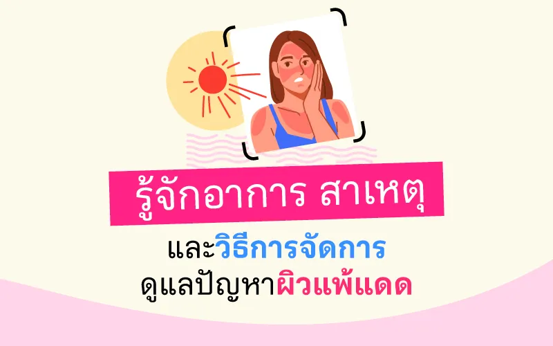 รู้จักอาการ สาเหตุ และวิธีการจัดการดูแลปัญหาผิวแพ้แดด